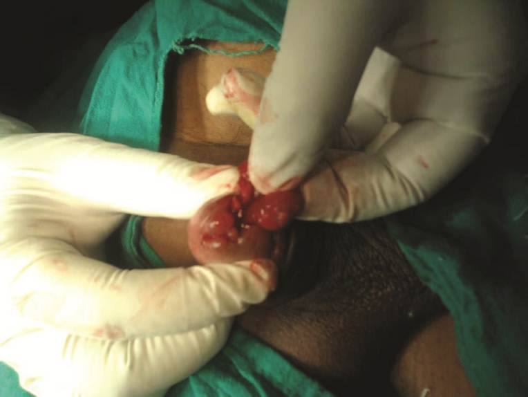 Shawn recommends best of Pee hole procedure Vintage group sex porn