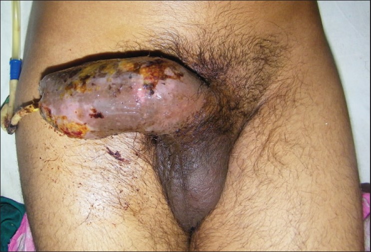 Penis Erection Image 34