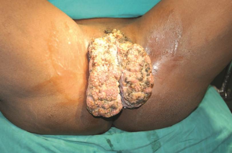 cura de detoxifiere pentru colon