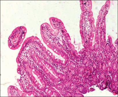 giardia histology stain