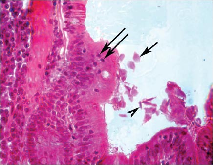 Giardia duodenum histology, Giardia histology